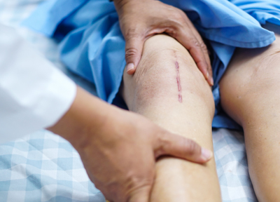 Total-joint-replacement-rehab